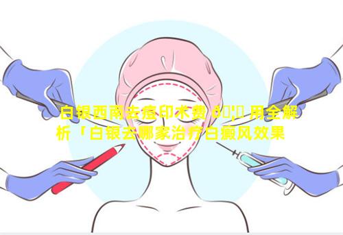 白银西南去痘印术费 🦋 用全解析「白银去哪家治疗白癜风效果 🌸 好」